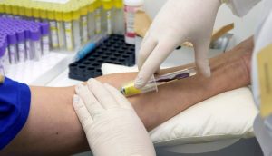 Infermiere effettua un prelievo di sangue, utile per scoprire i livelli di creatinina